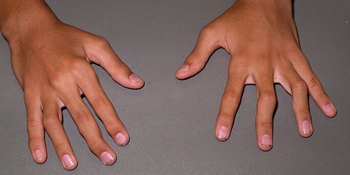 Fingergelenke tun weh